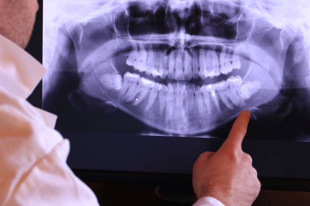 Best Orthodontic Emergency Dentist in Chico, TX