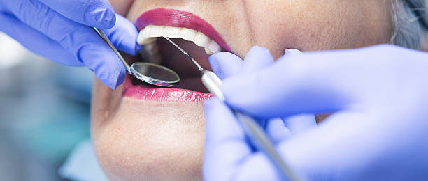 Best Emergency Dentist for Lost Fillings or Crowns in Chico, TX