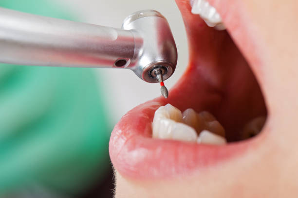 Best Urgent Dental Care for Toothache in Chico, TX